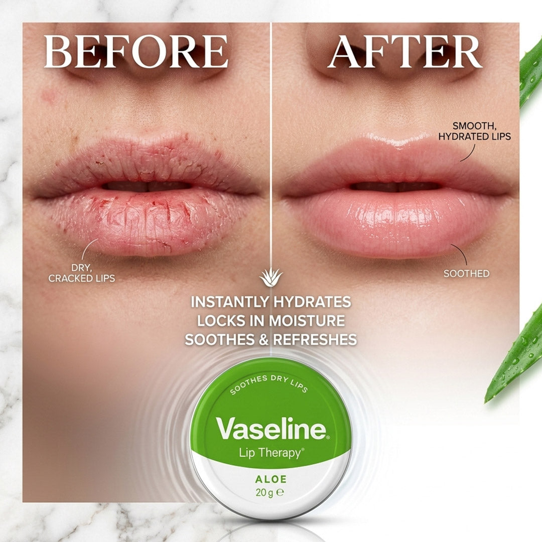 Vaseline Lip Therapy Balm Petroleum Jelly 20g pack of 2, 3 or 4 Pocket Size Pots